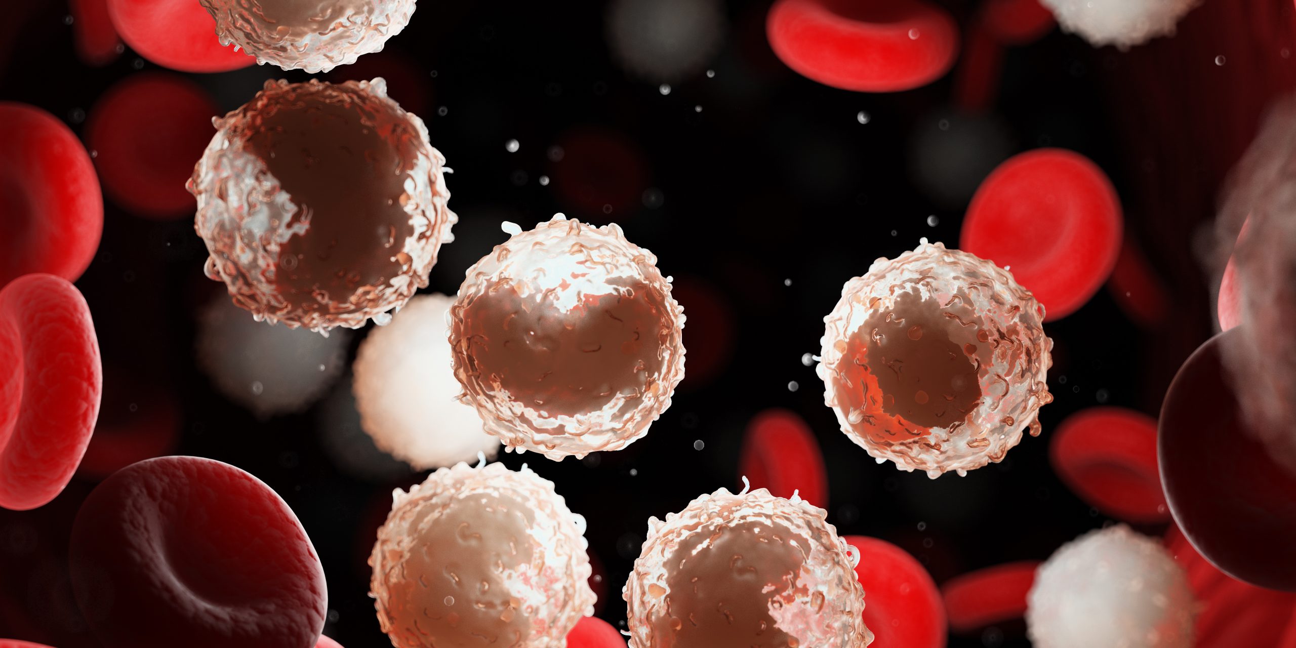 Advances in Chronic Lymphocytic Leukemia Care